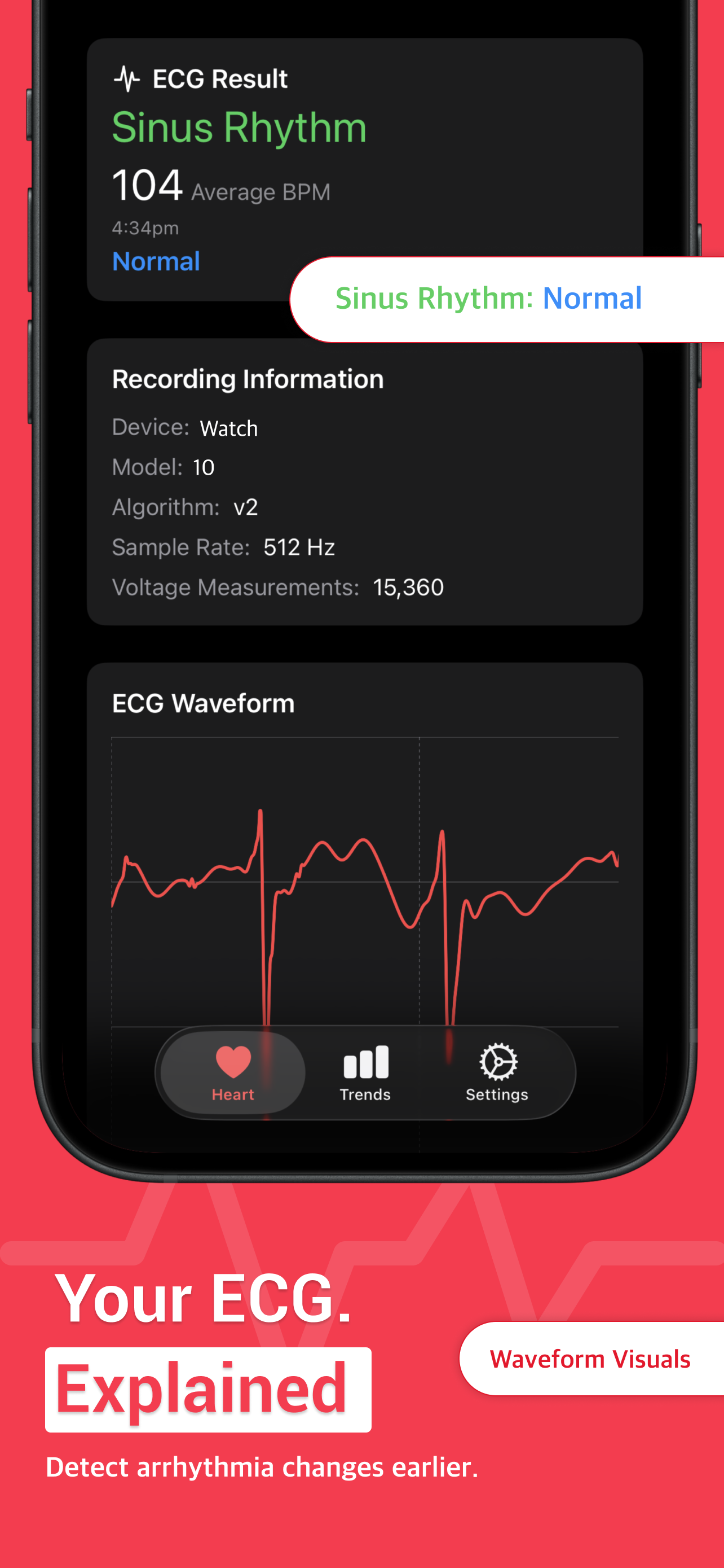 CardioSense - Heart Monitoring