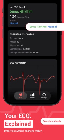CardioSense - Heart Monitoring screenshot 5