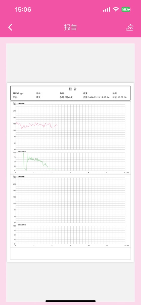 康泰优贝 - contec-baby-fetal-monitoring-report