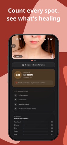 Acne Tracker: Skin Journal Screenshot 3 of 10