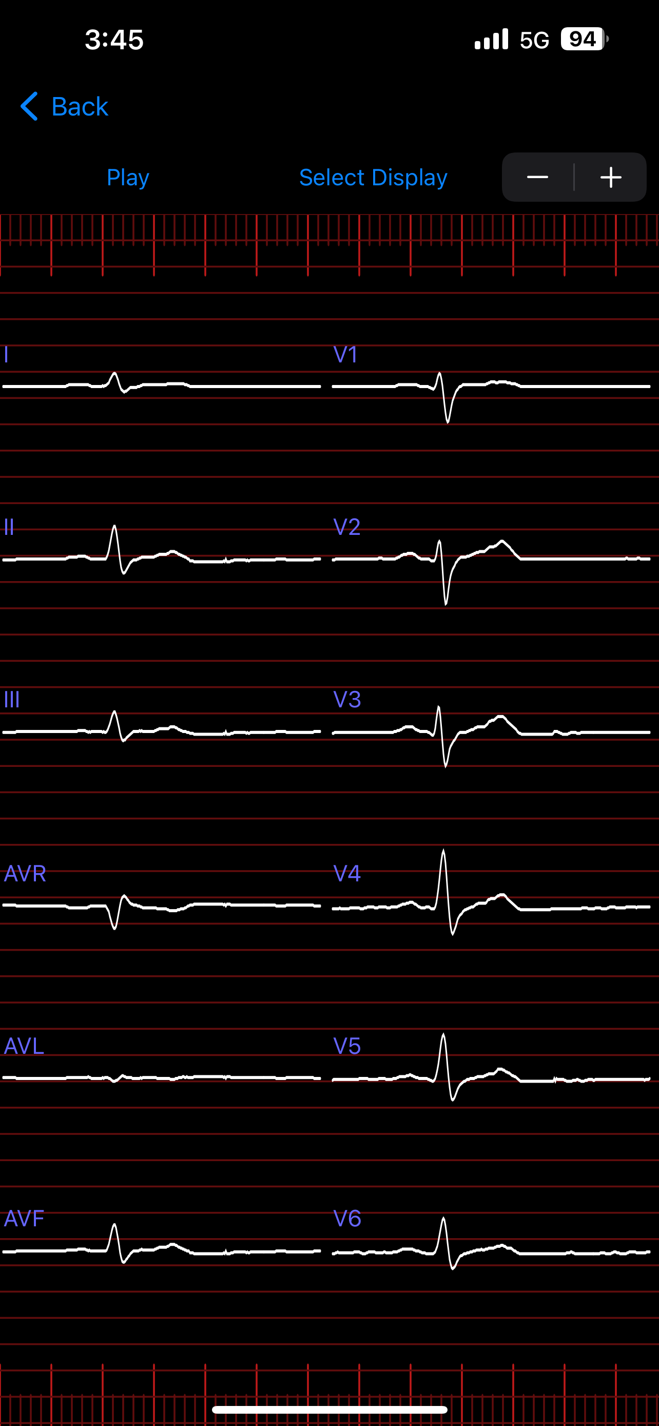 Nasiff CardioCard Mobile