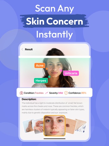 AI Skin Care Scanner・Acne Safe iPad screenshot 1