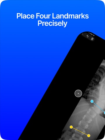 Cobb Angle Pro Spine X-Ray iPad screenshot