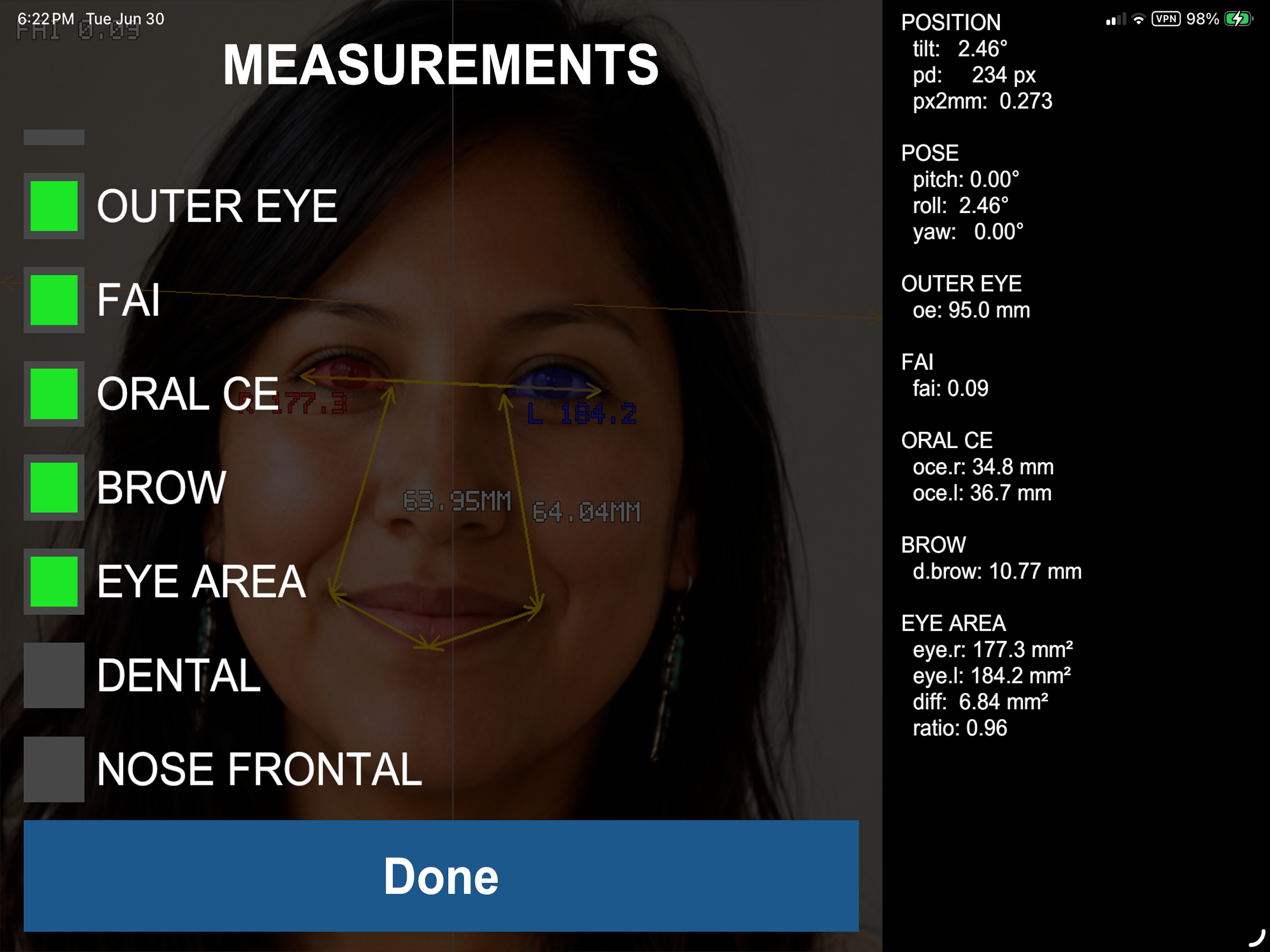 Dynaface screenshot 9