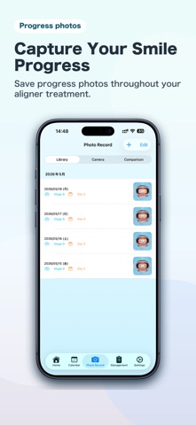AlignerTracker - All In One Screenshot 9 of 10