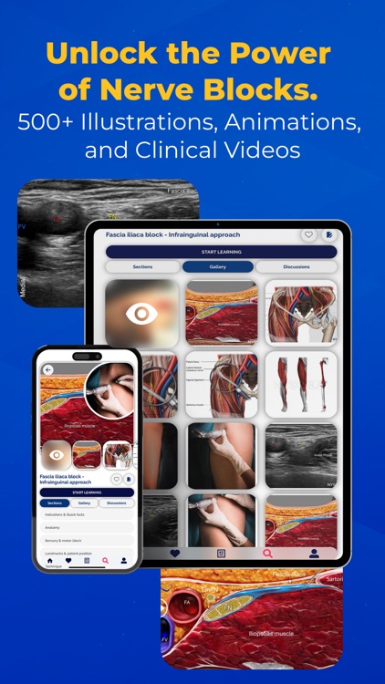 NYSORA Nerve Blocks screenshot-4