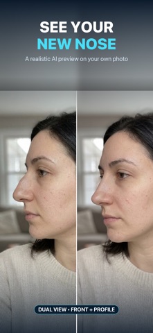 Nose Job - Plastic Surgery AI screenshot