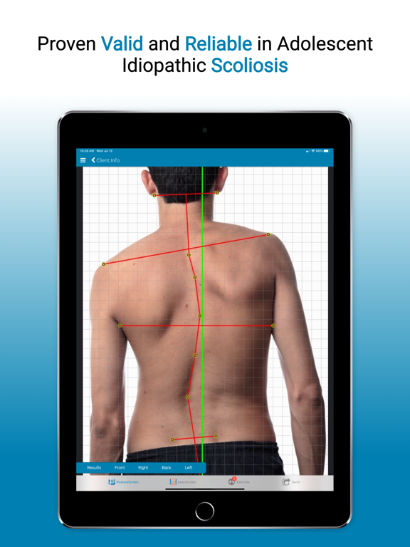 Screenshot #6 pour PostureScreen Mobile