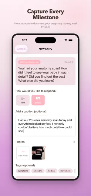 BabyBound: Pregnancy Journal screenshot 3