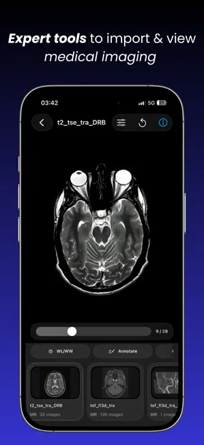 DICOM Viewer : MRI CT XRAY & + iPhone screenshot 1