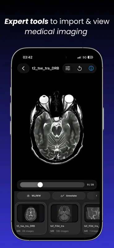 DICOM VIEWER MRT CT Röntgen screenshot 1 of 8
