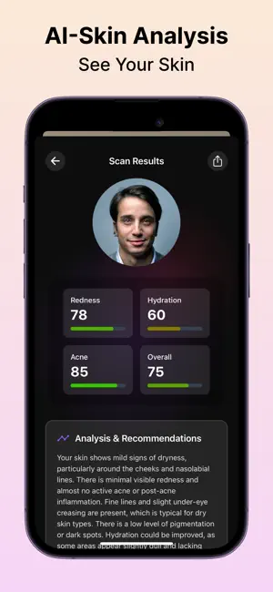 SimplySkin - AI Skincare screenshot 2