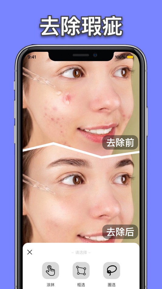#5. 无痕消除笔-照片杂物去除,橡皮擦&图片编辑 (iOS) 由: 雅琴 邓
