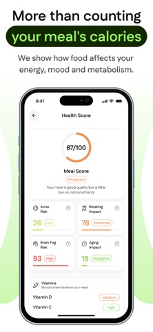 Slim AI – Calorie Tracker iPhone screenshot