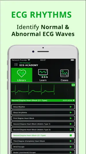 ECG for Doctors | EMT | AEMT screenshot 4