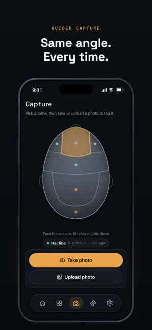 Norwood: Hair Loss Tracker screenshot 4