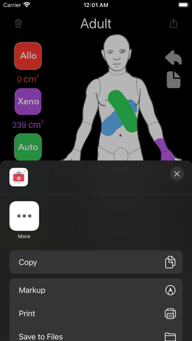 Screenshot 4 of Medical Burn App