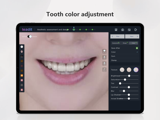 Smile Design Pro iPad screenshot 5 - Medical app