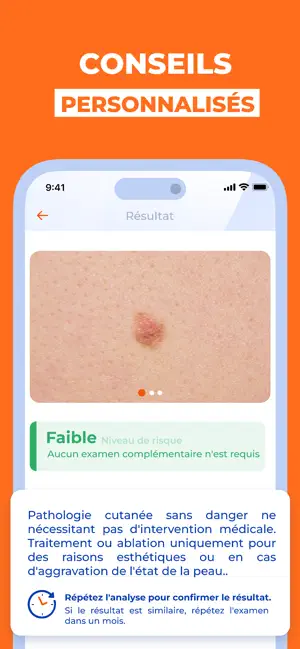 Scanner IA Santé de Peau iPhone screenshot 5