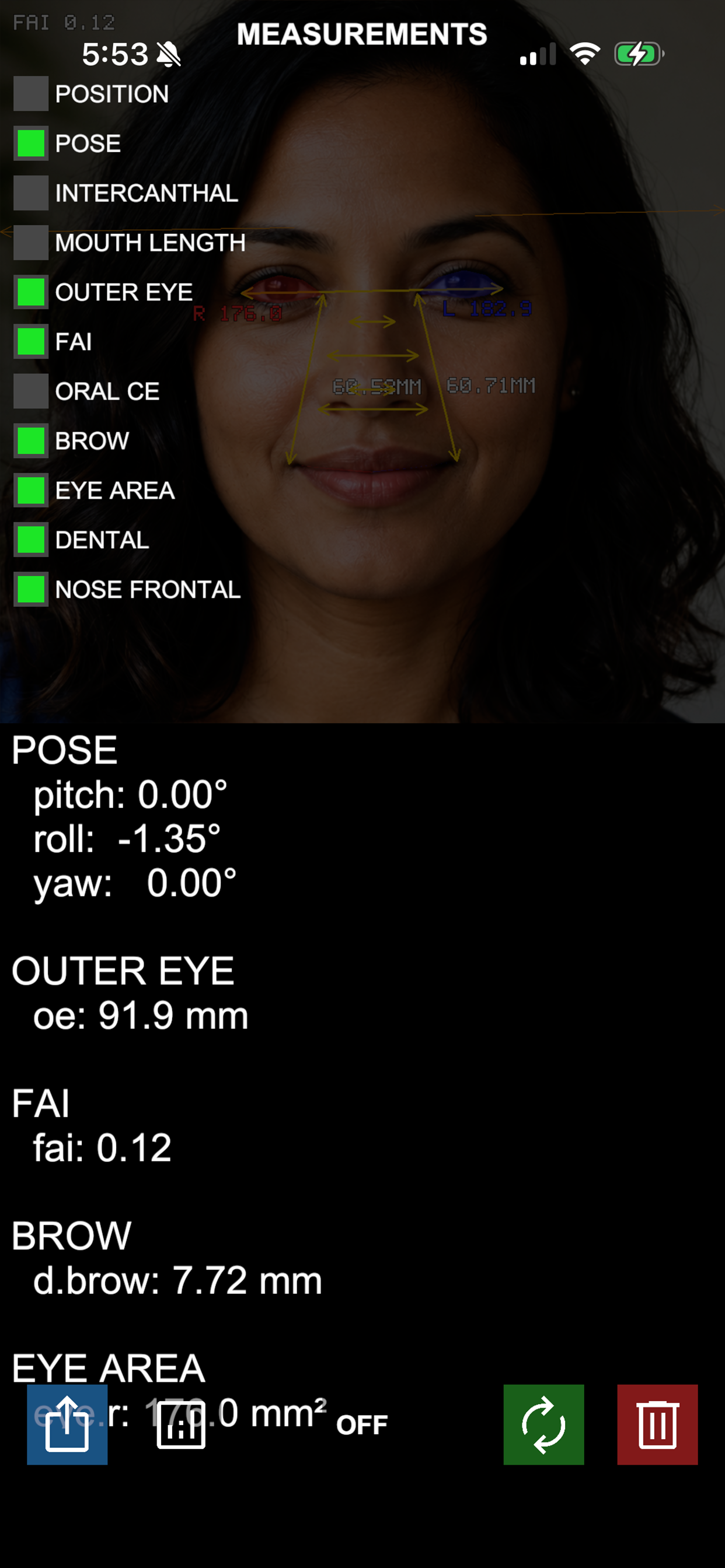 Dynaface screenshot 3