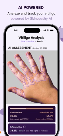 Skinopathy Vitiligo screenshot