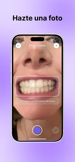Captura de pantalla de Blanq Ai: Blanquea Tus Dientes en iPhone 1