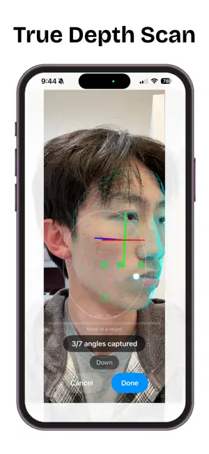 Skin AI - Acne Tracker screenshot 3