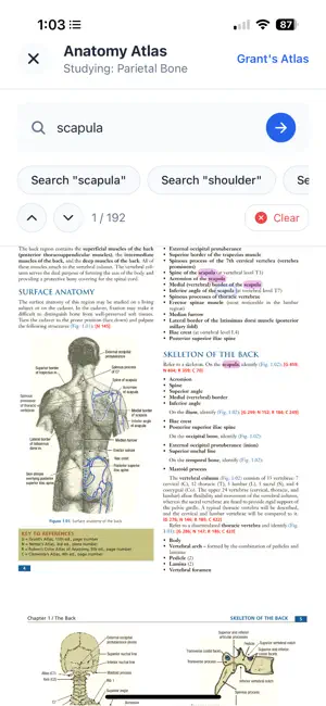 Anterior3D screenshot 2