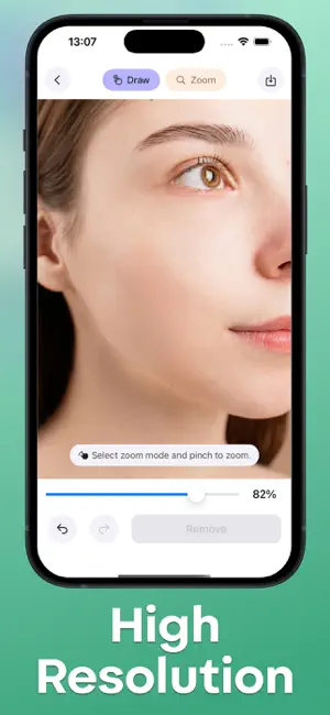 Acne Remover - Pimple Eraser screenshot 3