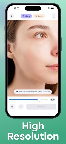 Acne Remover - Pimple Eraser screenshot