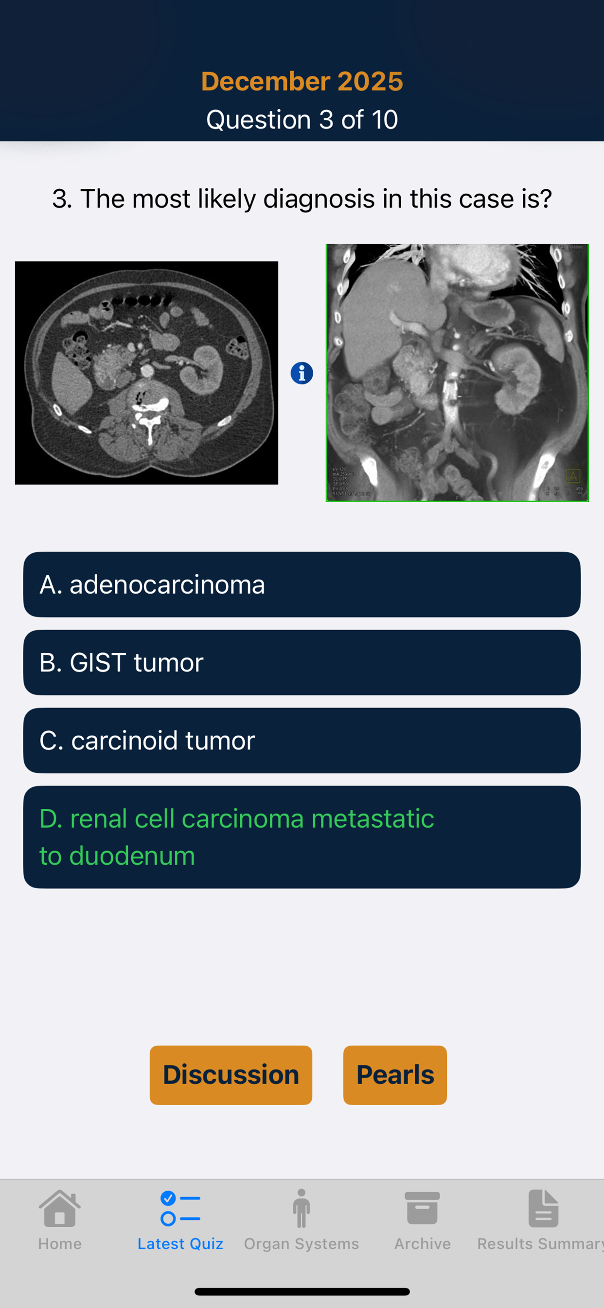 CTisus iQuiz 26