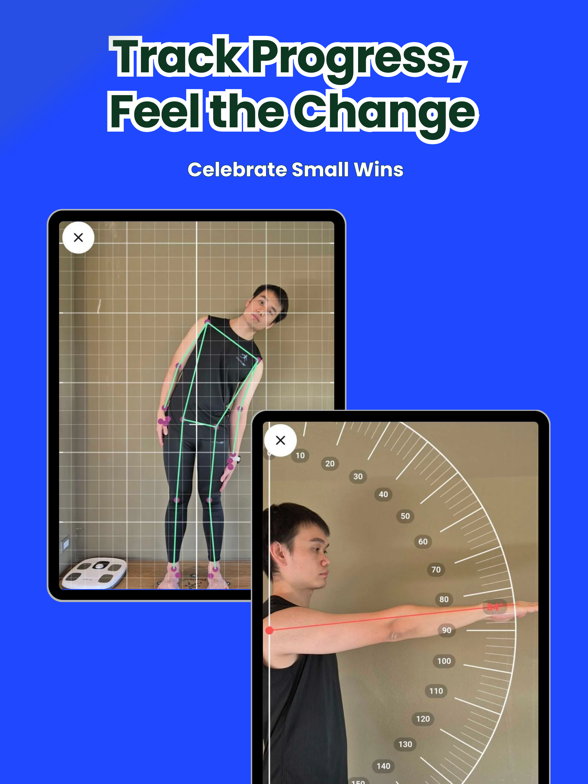 AI Posture Therapy: PhysioAI