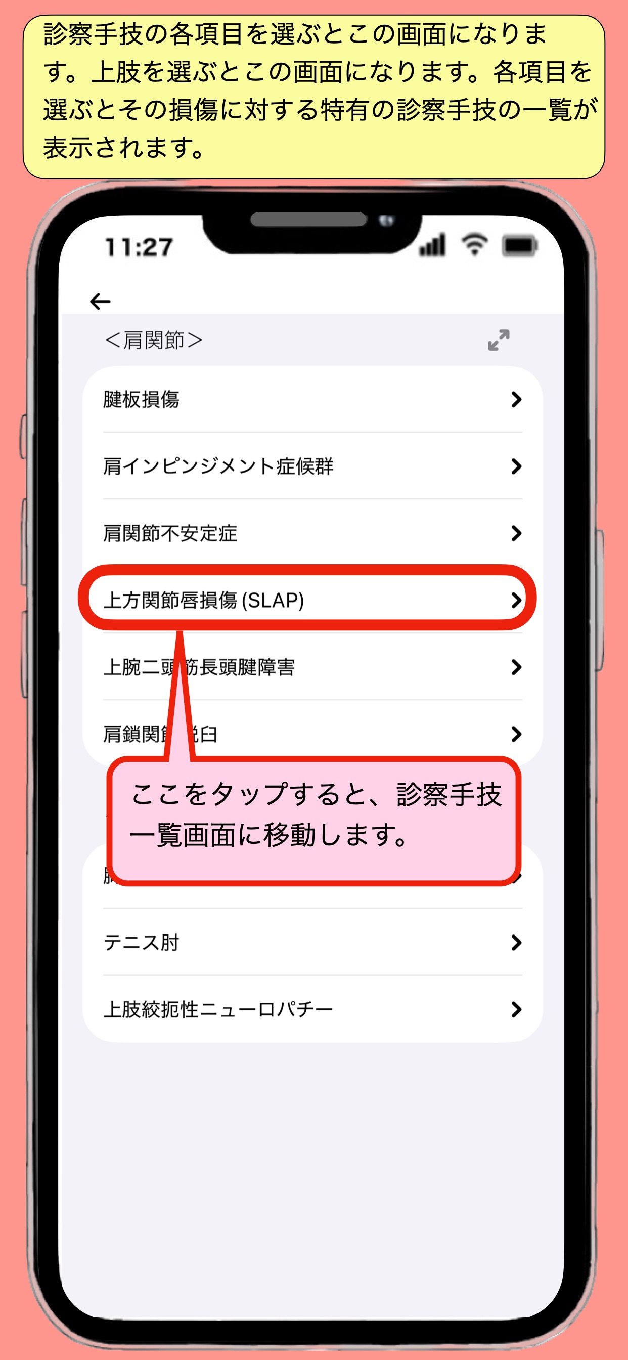 Screenshot 7 of 整形外科治療ガイド_骨折から理学所見まで