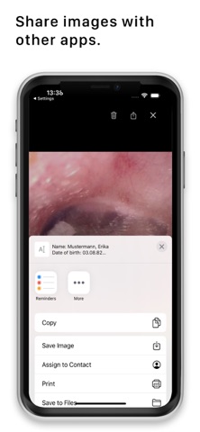 HEINE AURIS screenshot