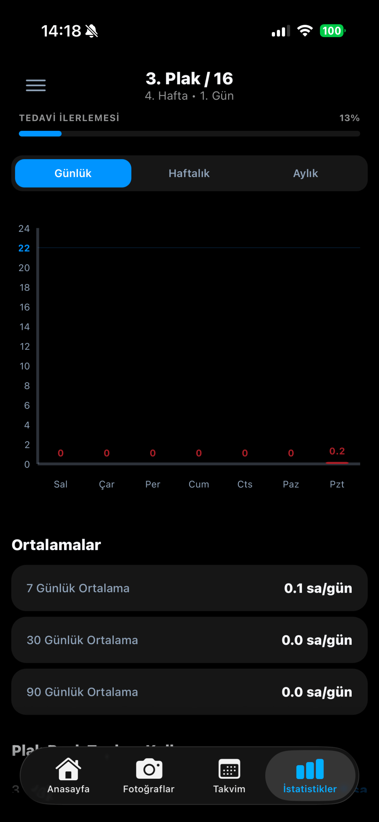 OrthoFlow: Aligner Tracker screenshot 3