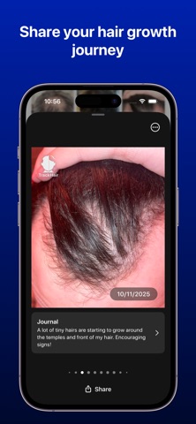 Track Hair - 脱发记录 screenshot
