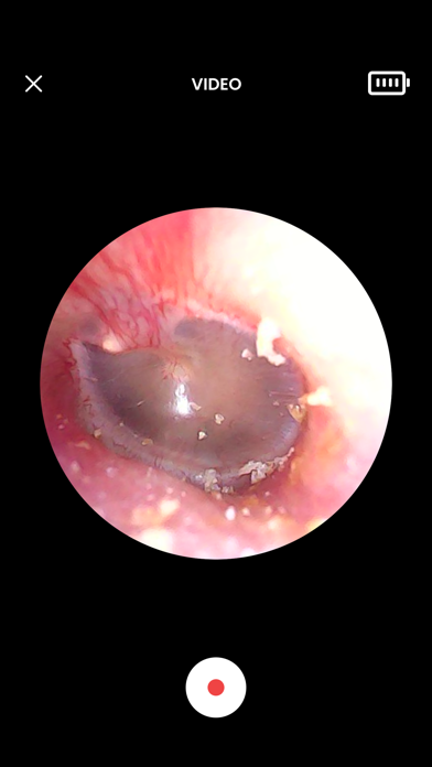 Blueberry Pediatrics Otoscope Screenshot
