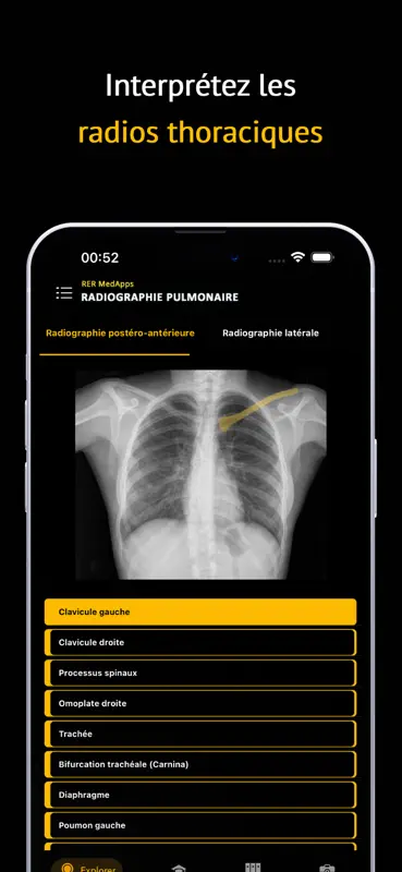 Maîtrise Radio Thorax screenshot 1 of 5