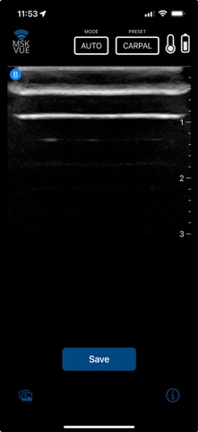 MSK VUE screenshot