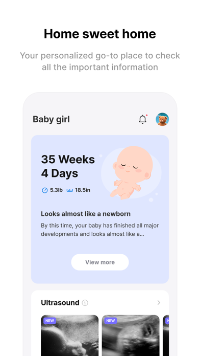 Momitalk: Pregnancy Ultrasound Screenshot