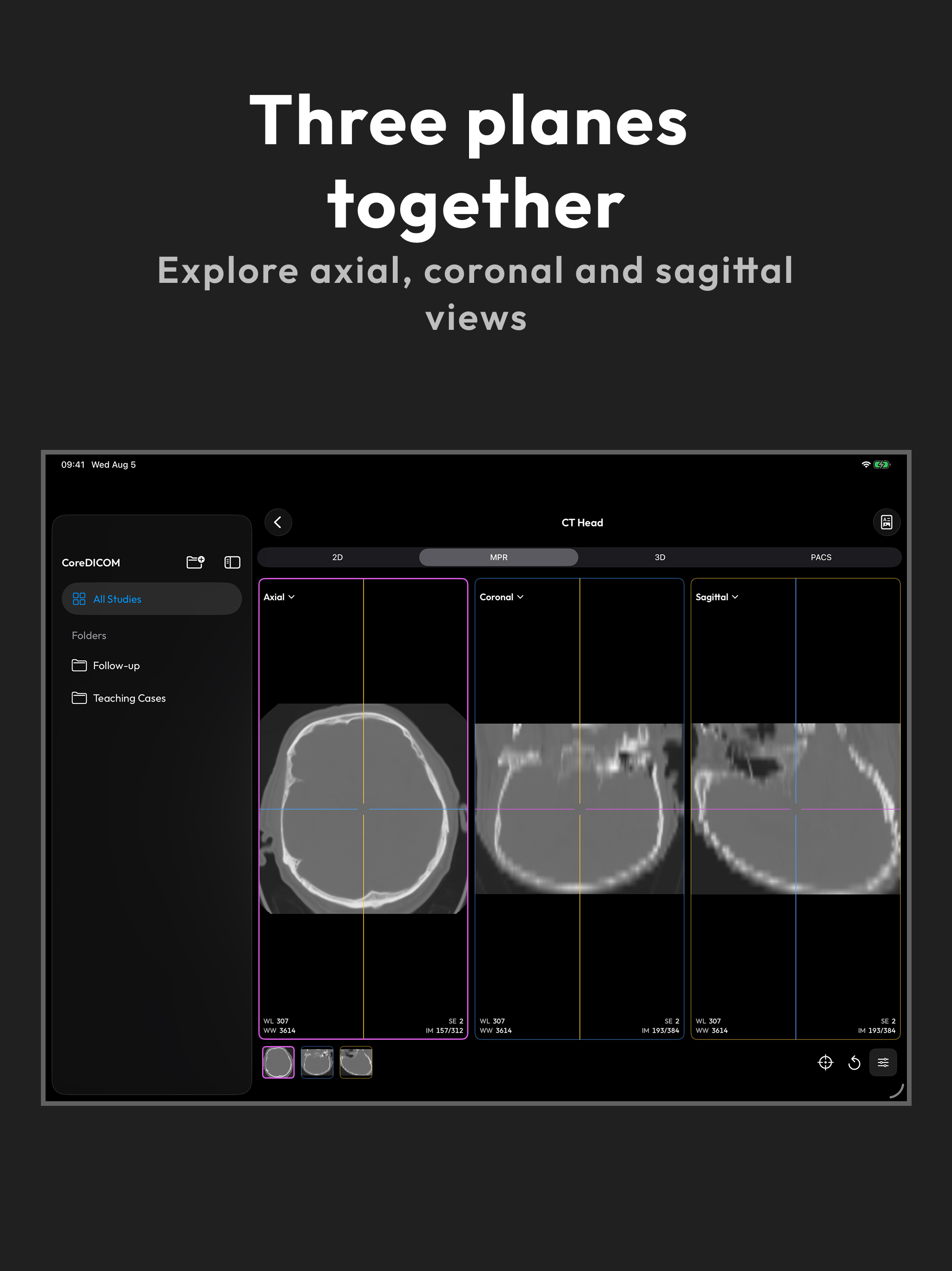DICOM File Viewer - MesDICOM screenshot 10
