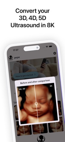 LittleLife 3D 4D Ultrasound 8K iPhone screenshot