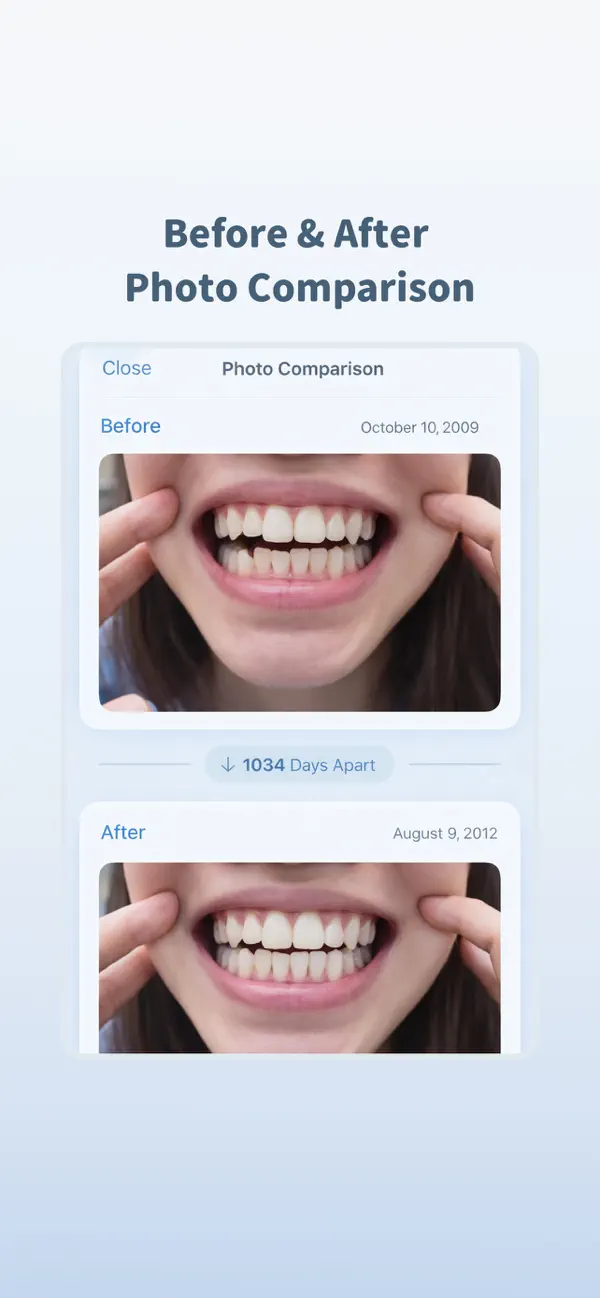 Screenshot #3 pour TooToo: Aligner Wear Tracker