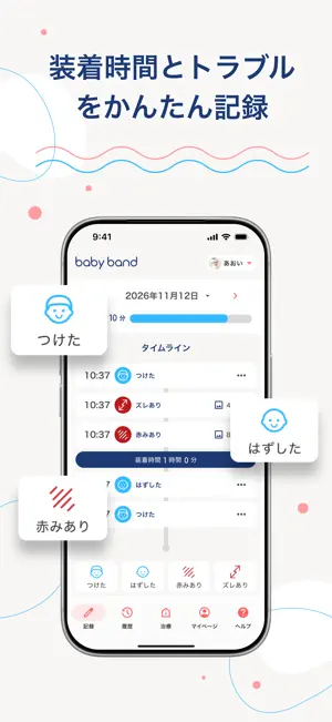 ヘルメット治療記録アプリ-babyband screenshot 3
