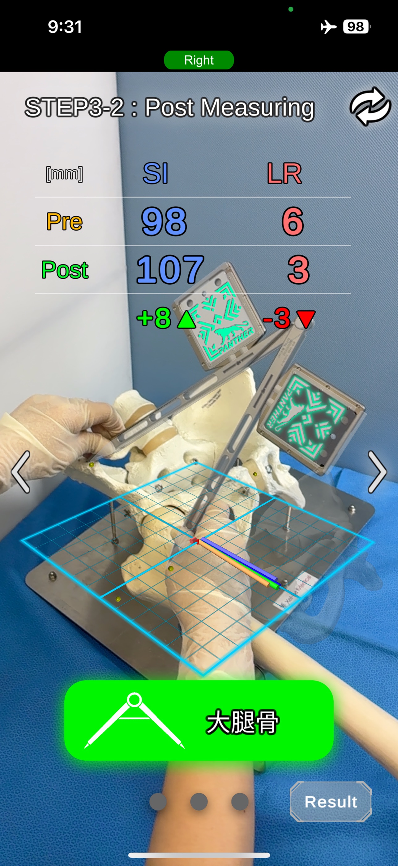 Screenshot 4 of OrthoPanther Leopard