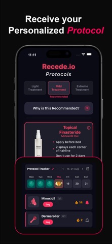 Recede.io – Predict Hairloss screenshot
