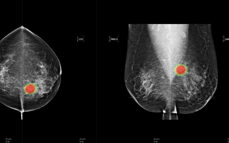 DICOM Viewer Pro Screenshot