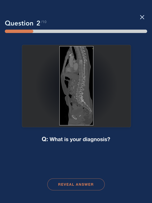 CTisus L-Spine Pathology iPad screenshot 5 - Medical app