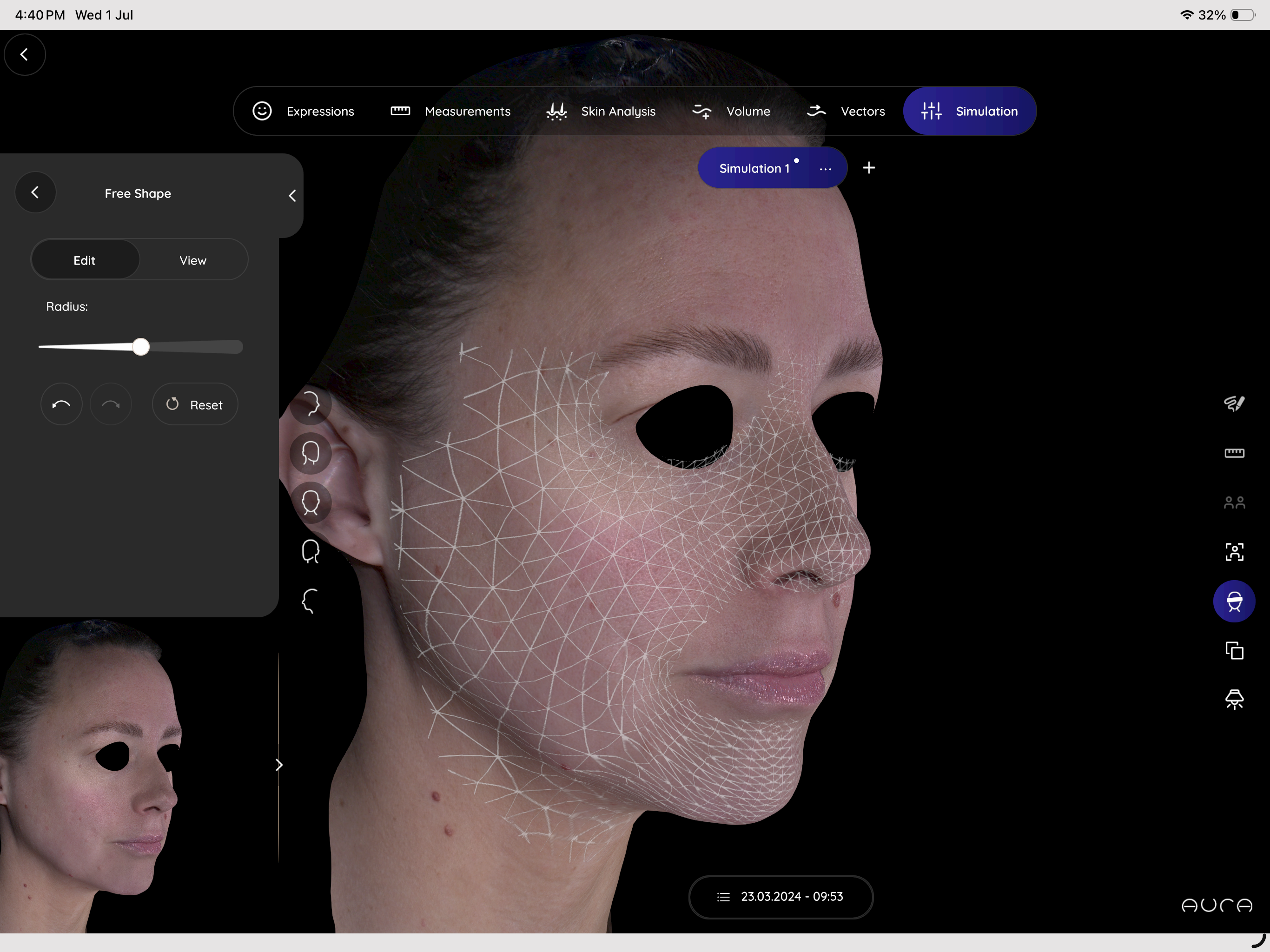 Aura 3D Imaging screenshot 4