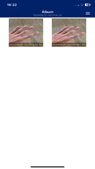 Captura de pantalla de CliniCAM en iPhone 4